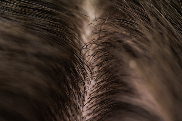 Medical hair loss diagnosis
