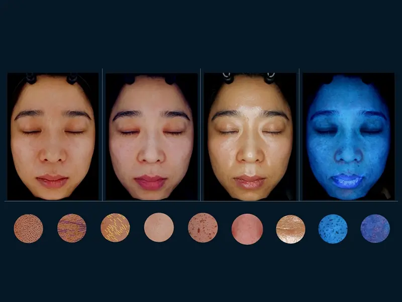 Multi-Spectral Imaging - FOCUSKIN