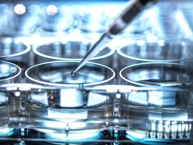 Stem Cell Therapy 치료